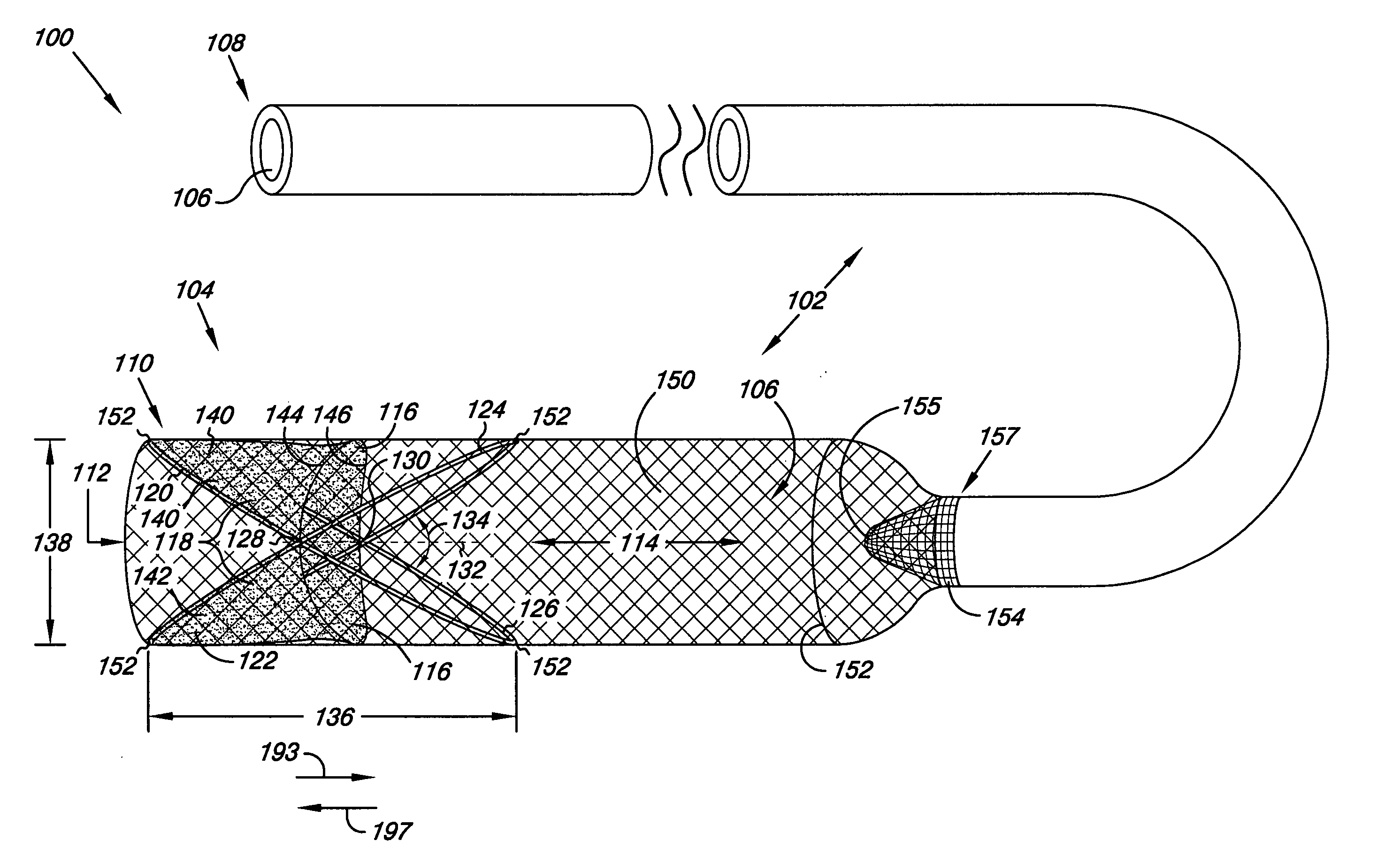 Filter system and method