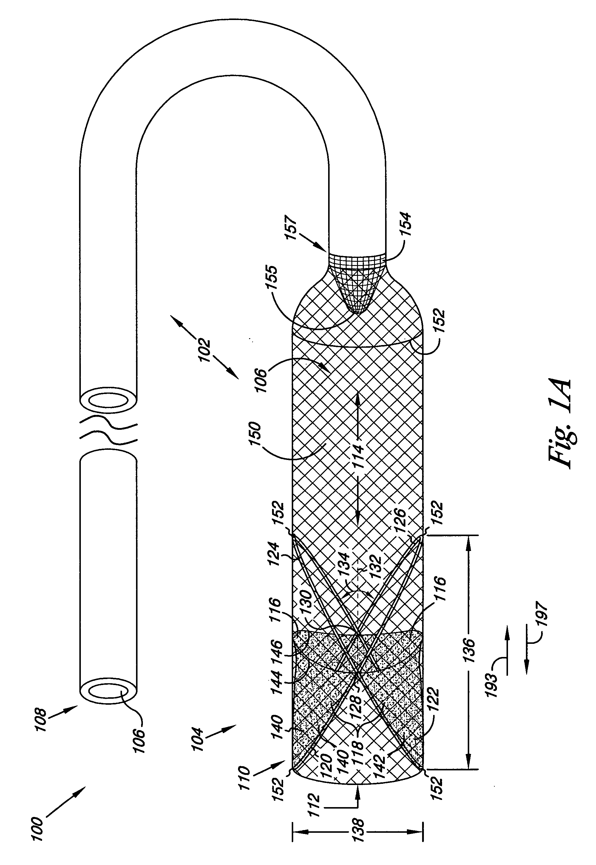 Filter system and method