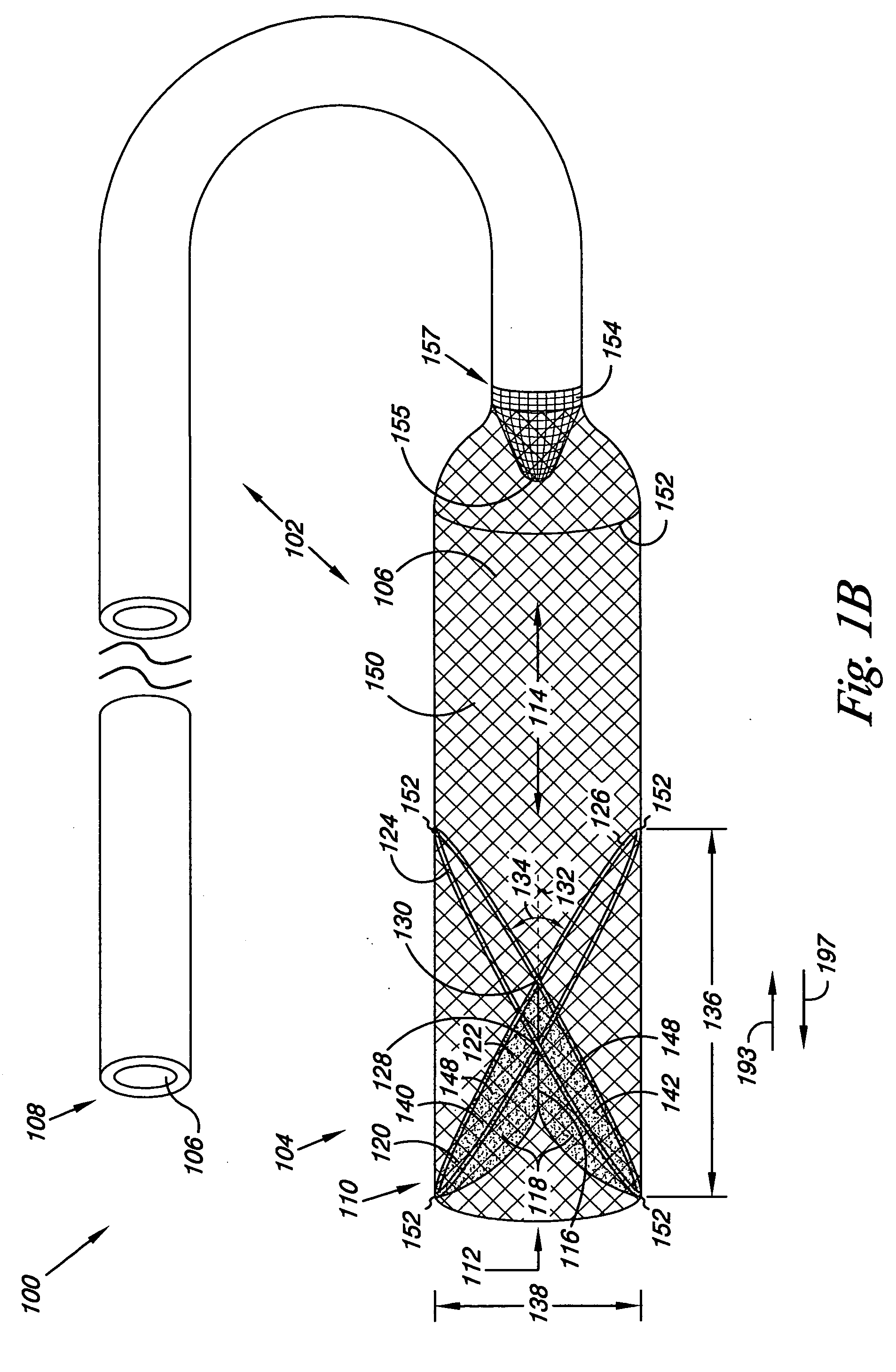 Filter system and method