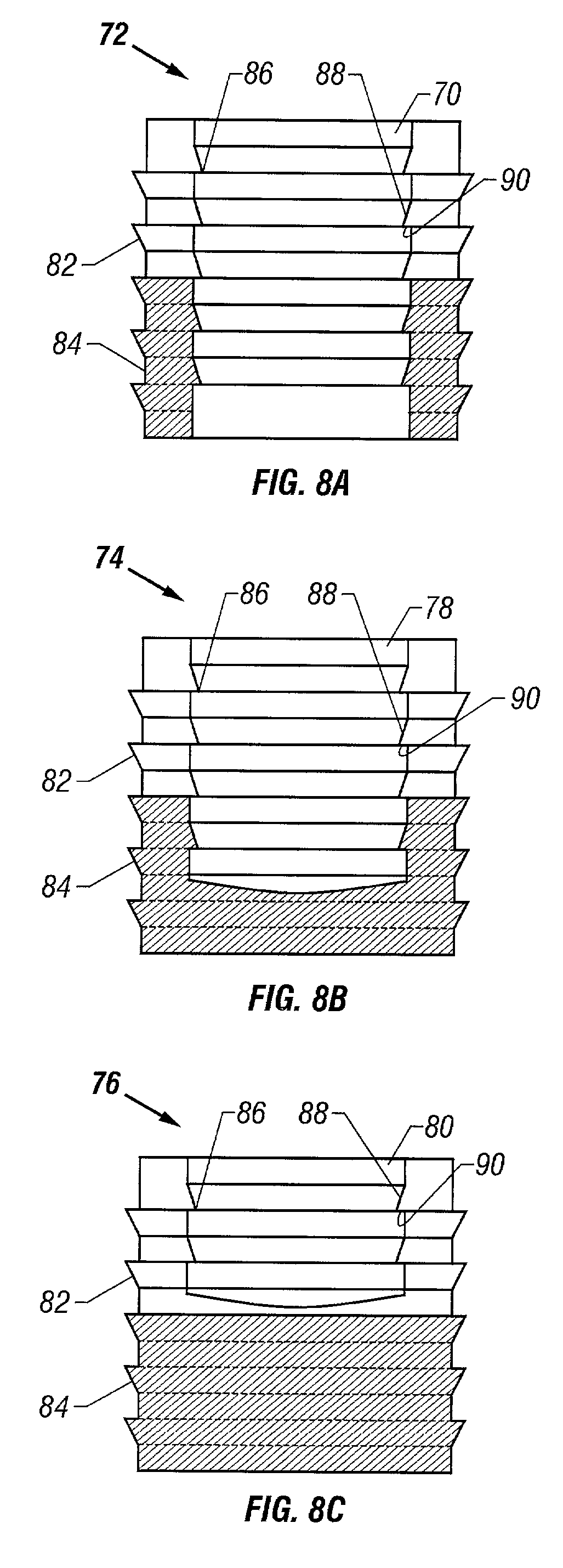 Cartilage repair plug