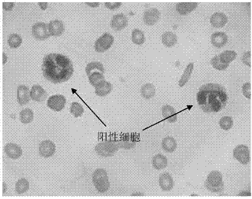 Chloroacetate AS-D naphythol AS-D chloroacetate esterase (AS-DNCE) staining solution (chemical coloring process)