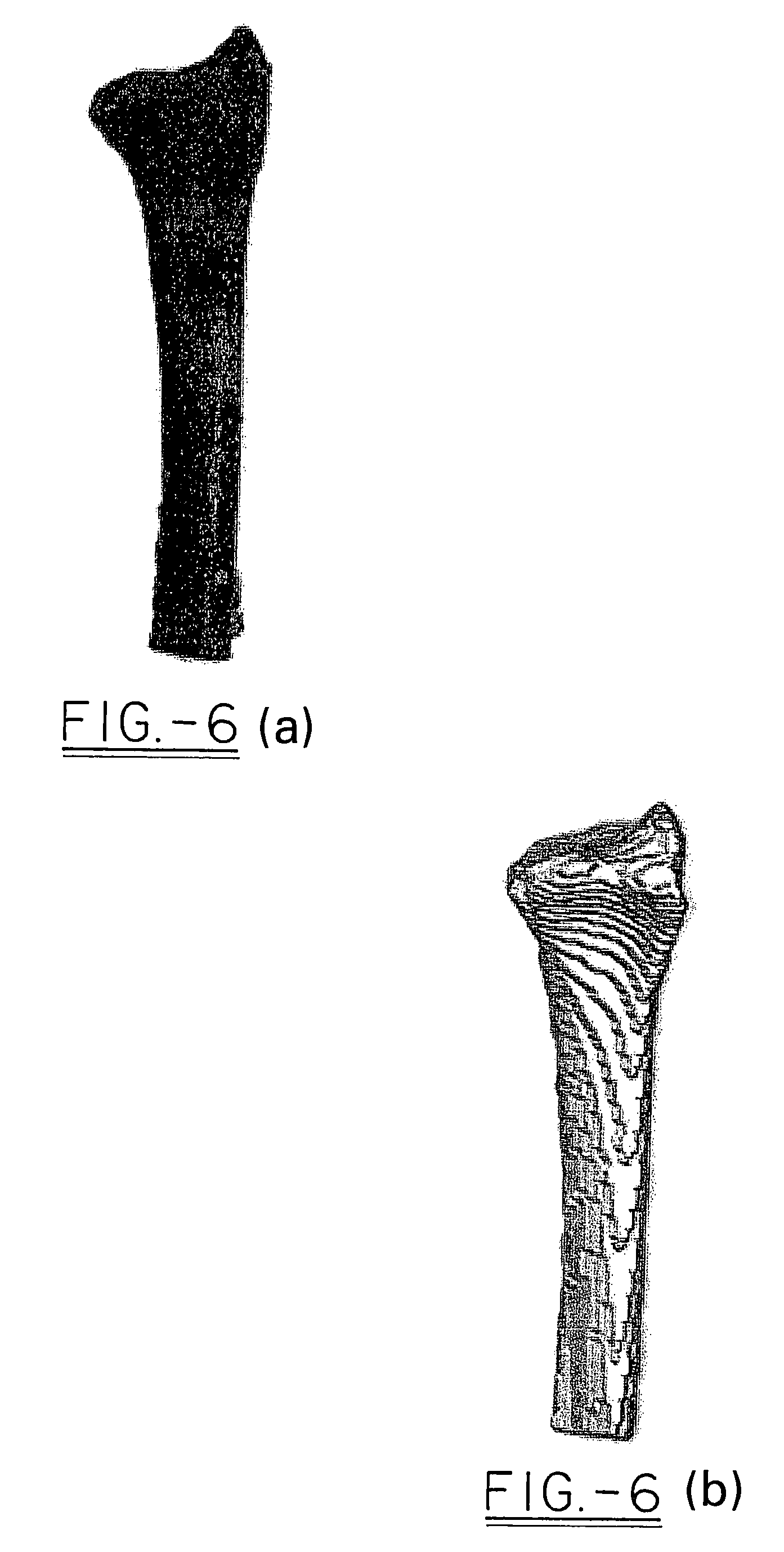 Method of making orthopedic implants and the orthopedic implants