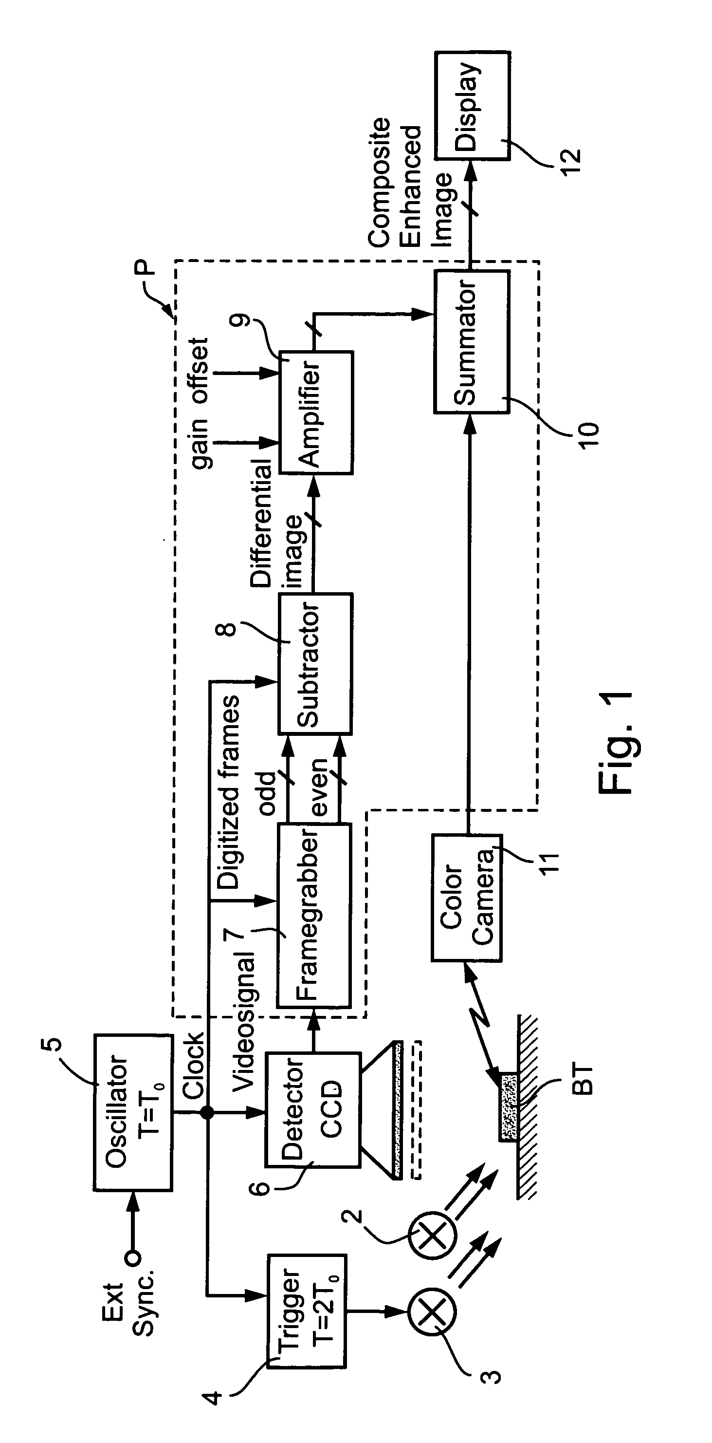 Optical examination method and apparatus particularly useful for real-time discrimination of tumors from normal tissues during surgery