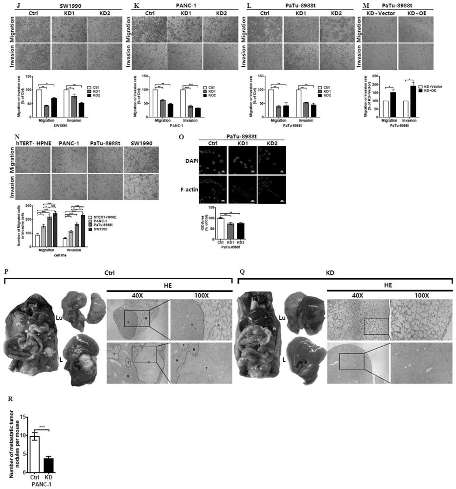 Application of metformin targeting COX6B2 in the preparation of drugs for the treatment of pancreatic cancer