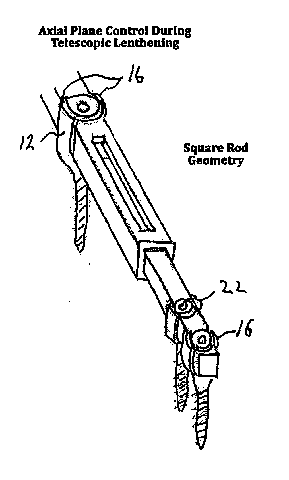 System and method for aligning vertebrae in the amelioration of aberrant spinal column deviation conditions in patients requiring the accomodation of spinal column growth or elongation