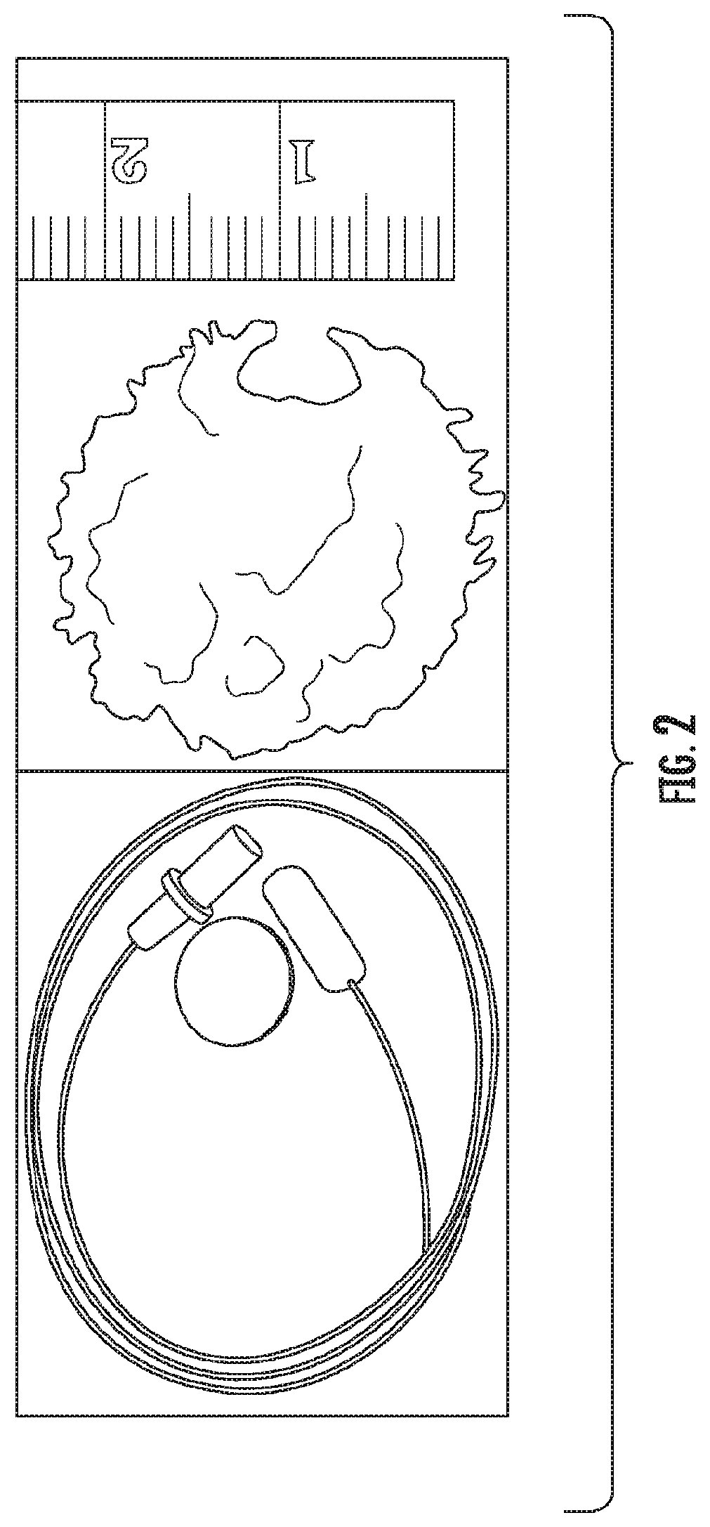 Methods for Detecting and Treating Esophageal Cancer