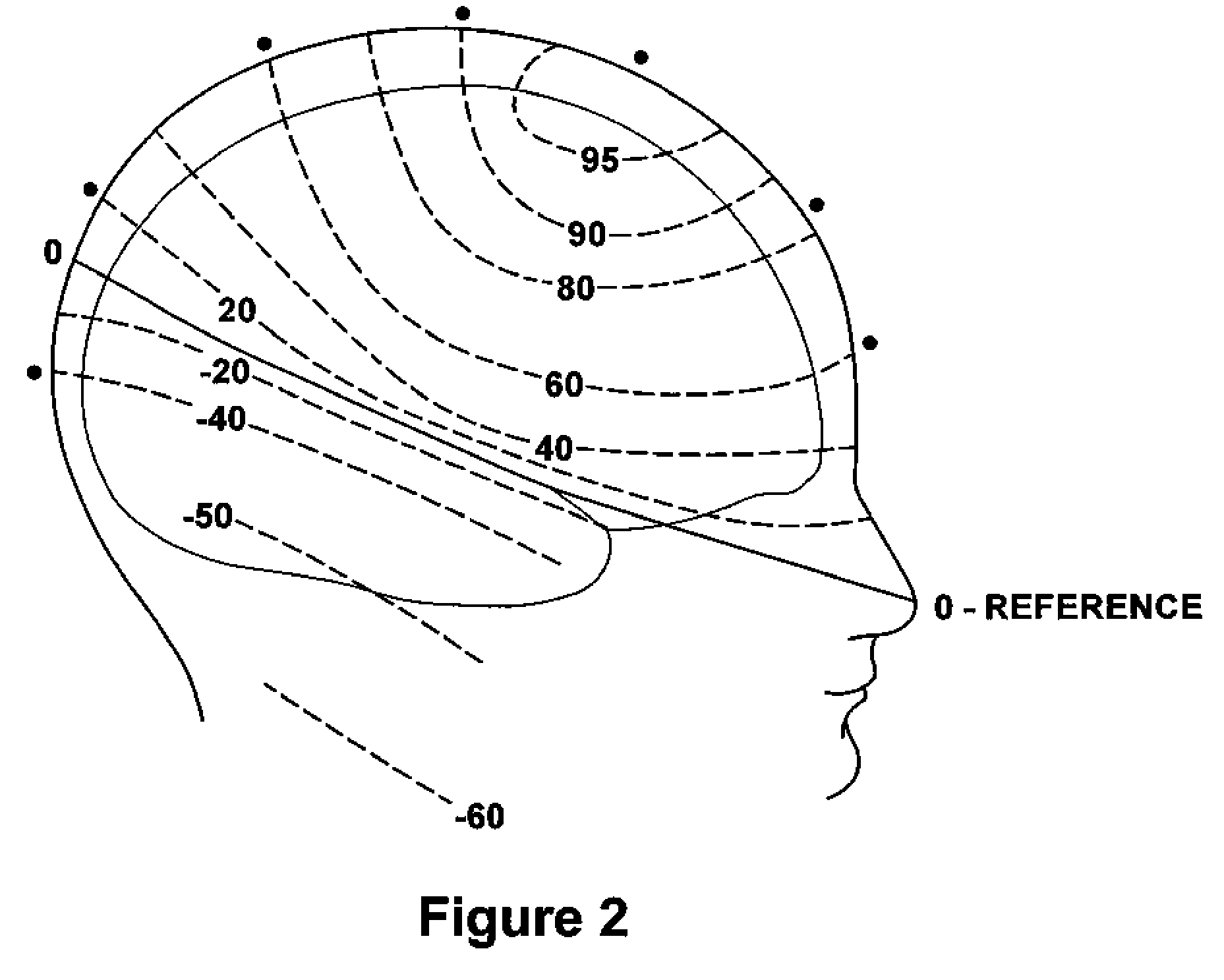 Multi-Channel, Multi-Variate Whole-Head Normalization Using Live Z-Scores