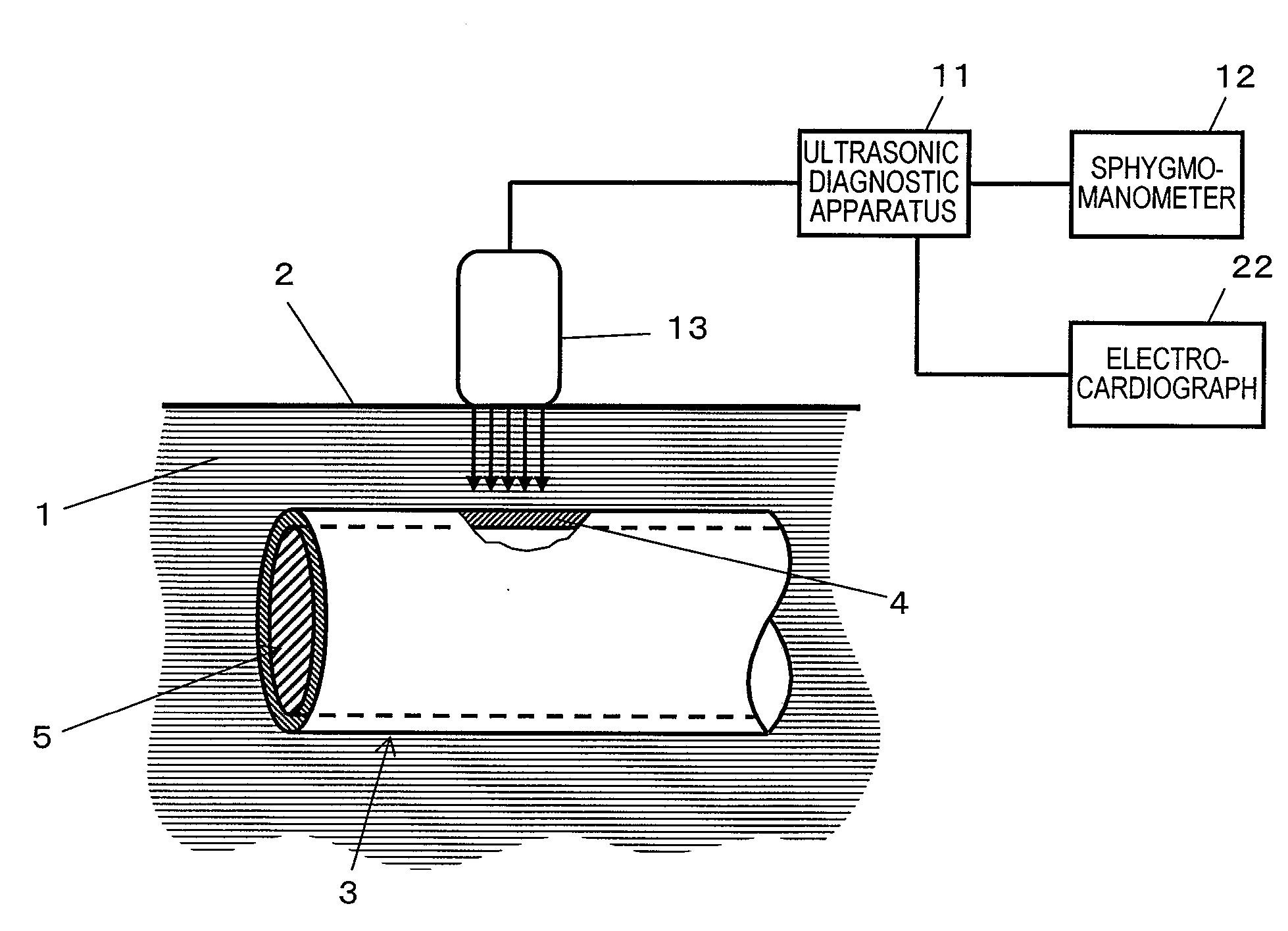 Ultrasonic diagnosis device and ultrasonic probe for use in ultrasonic diagnosis device