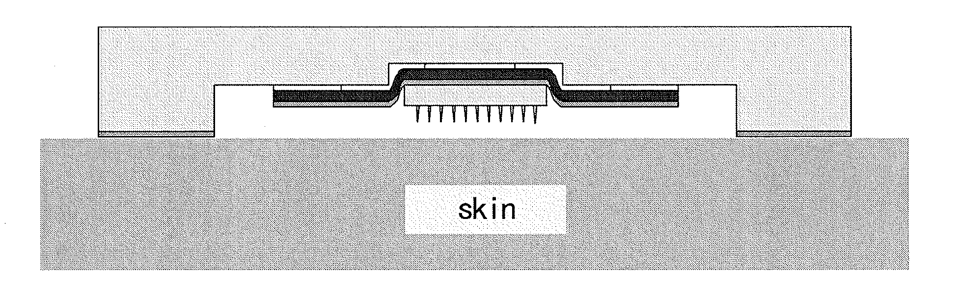 Applicator for microneedle array