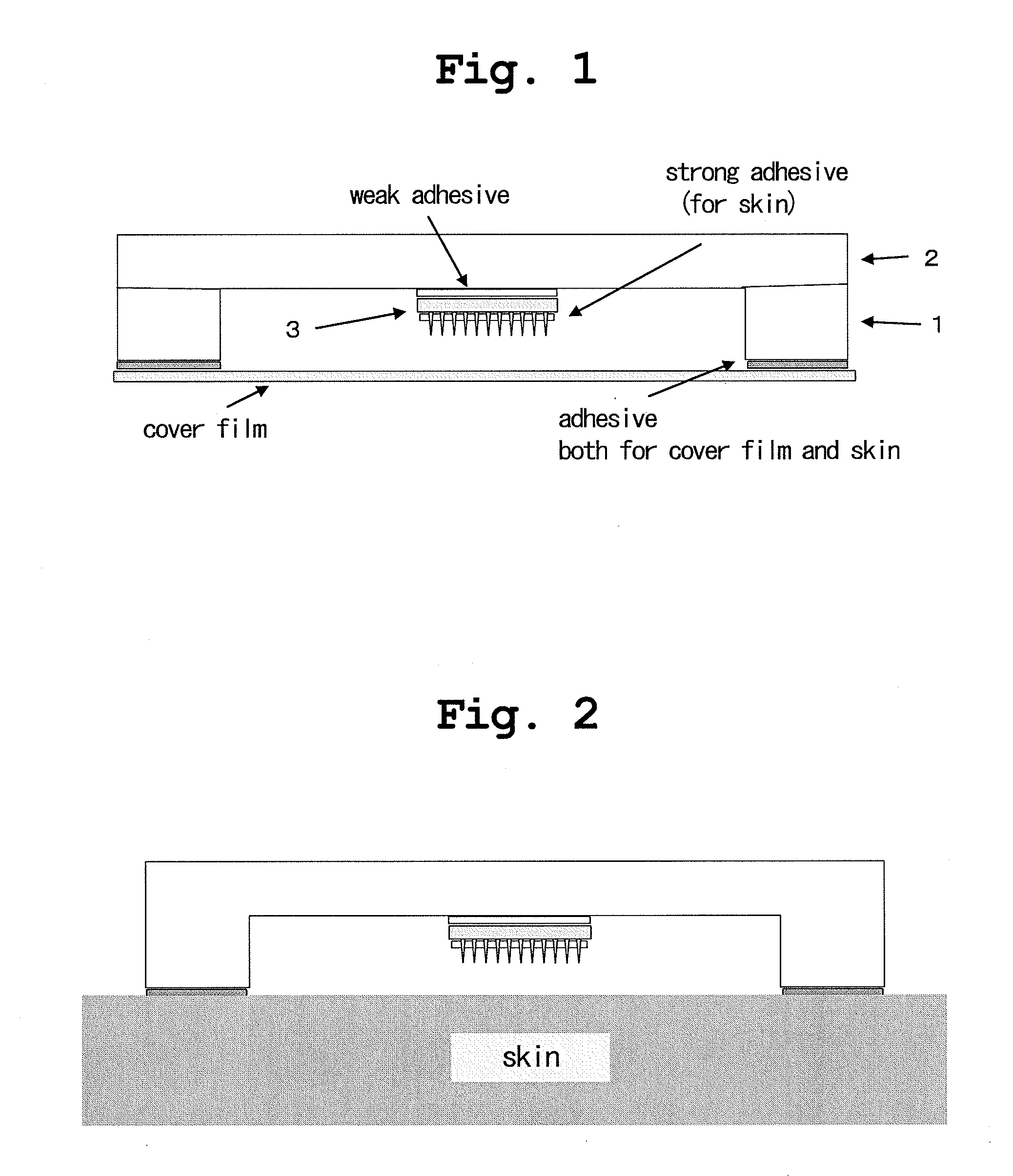 Applicator for microneedle array