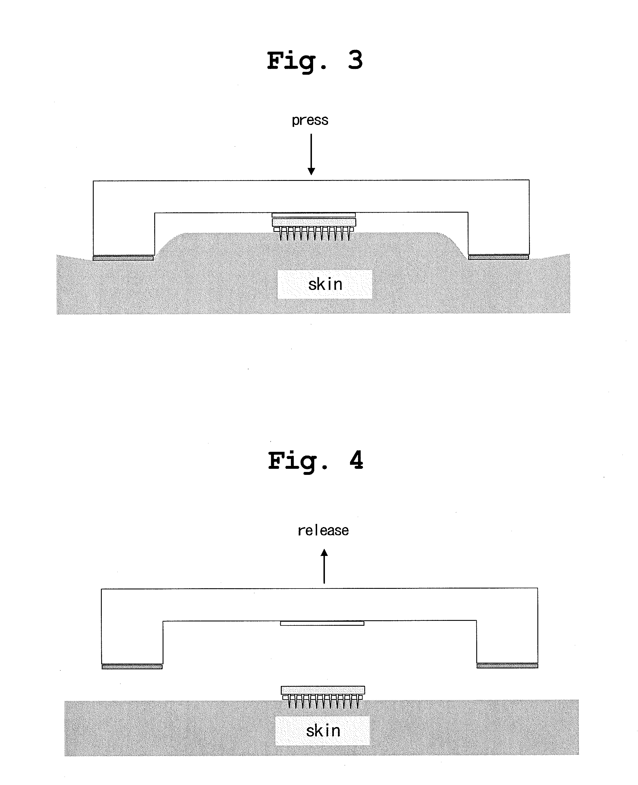 Applicator for microneedle array