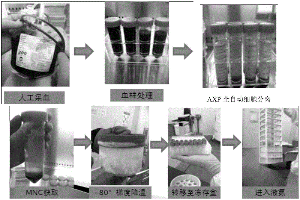 Method of automatically extracting immune cells in APB (Adult Peripheral Blood)