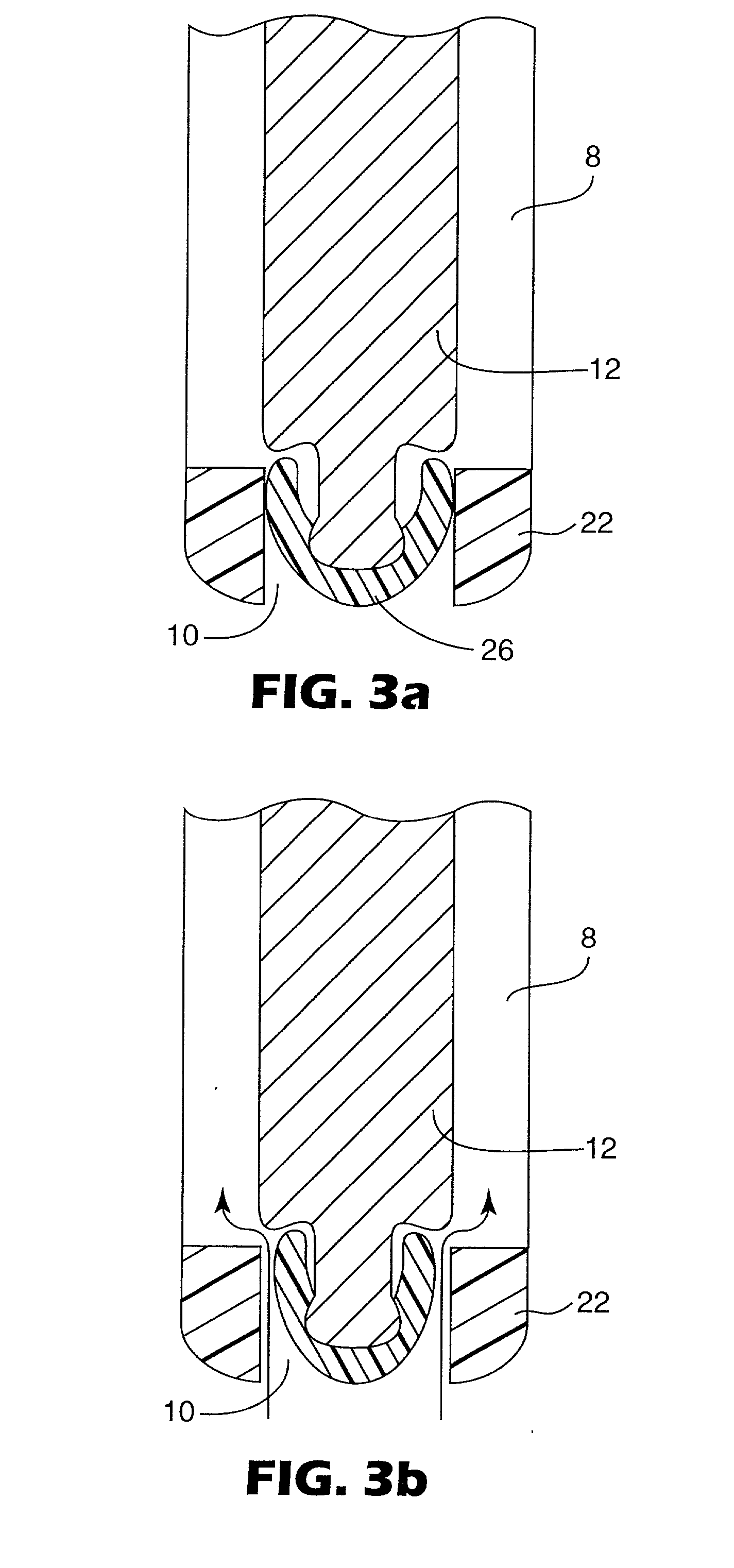 Metered dose dispensing aerosol valve