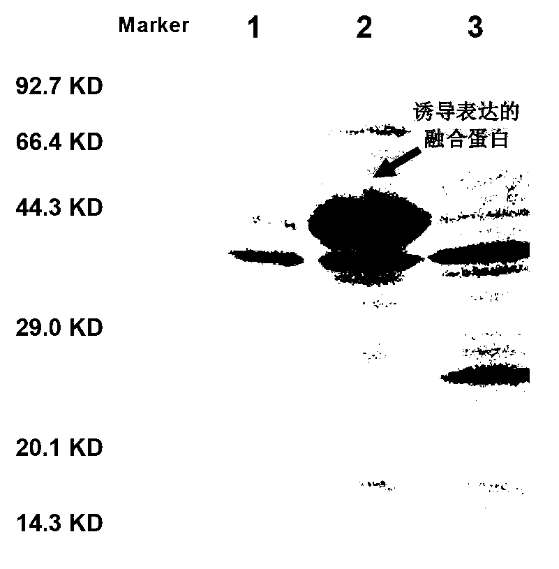 IgM specific protein Rv2915c of mycobacterium tuberculosis and application of IgM specific protein Rv2915c