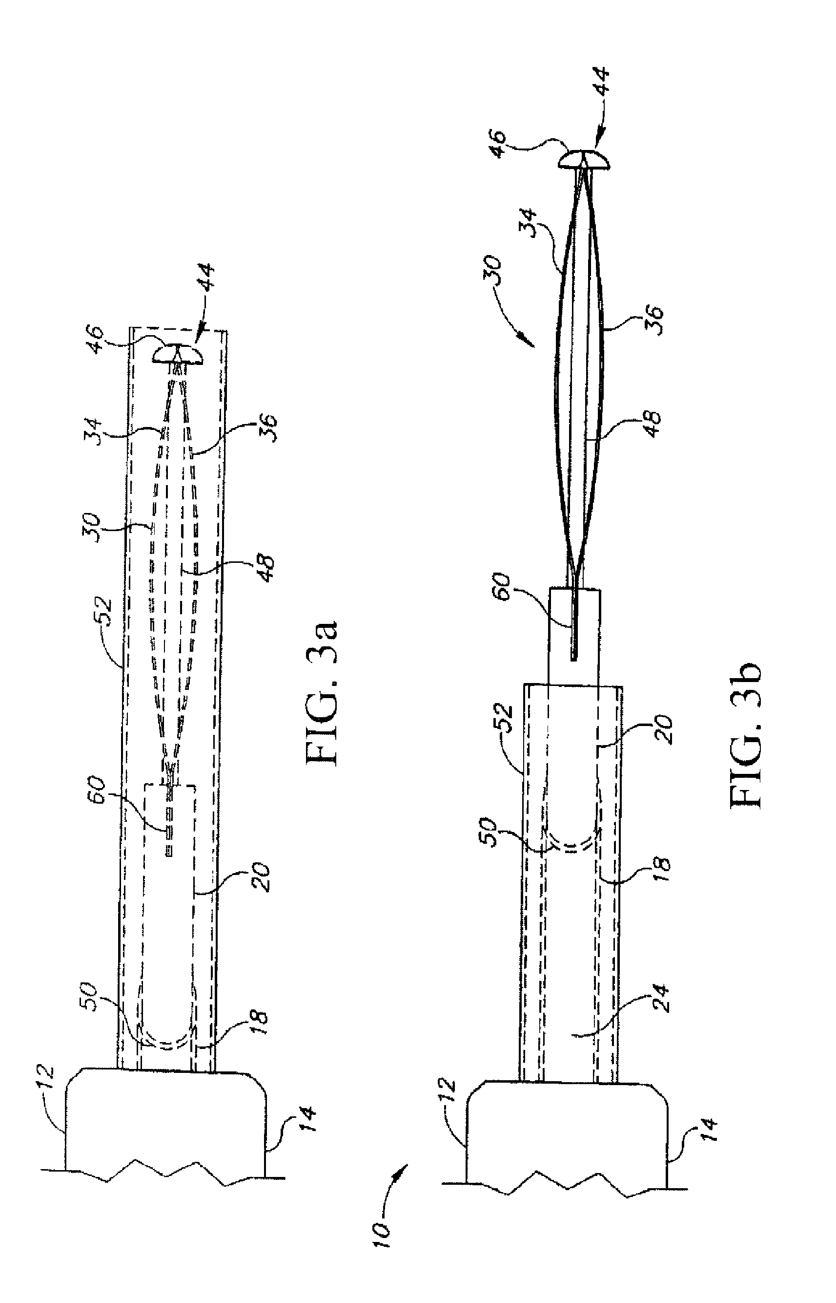 Circular thermal capsulotomy tool and system