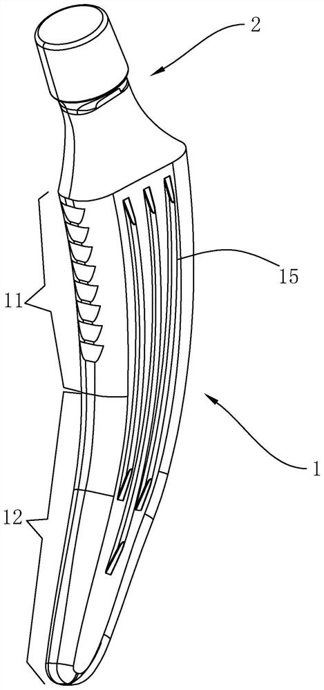 Hip joint prosthesis for use in femoral neck retention operation