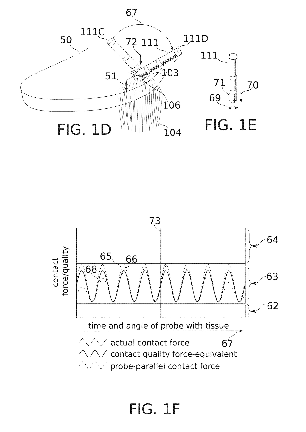 Contact quality assessment by dielectric property analysis