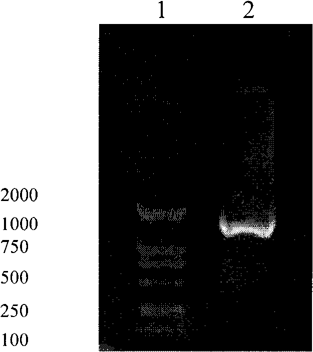 Expression method of human anti-zymoplasm III, special-purpose expression vector and engineering bacterium thereof