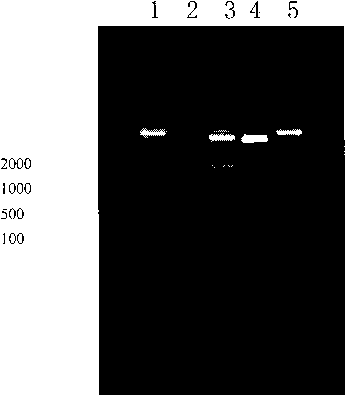 Expression method of human anti-zymoplasm III, special-purpose expression vector and engineering bacterium thereof