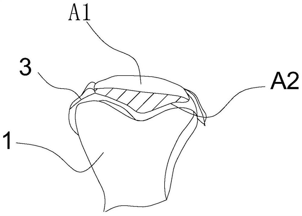 Design method of a patella prosthesis