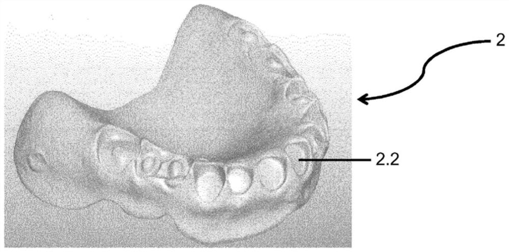 Method of manufacture of partial or complete dentures and dentures obtained according to this method