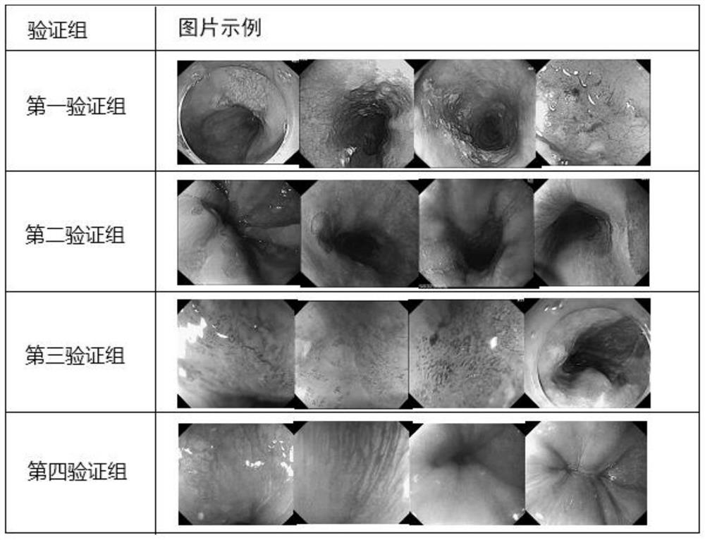 Picture screening method and system for esophageal cancer model training and storage medium