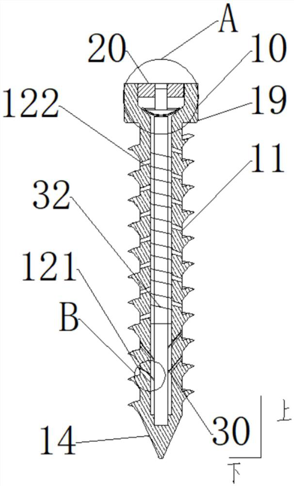 Bone screw with anti-regression and slow-release nutrient solution