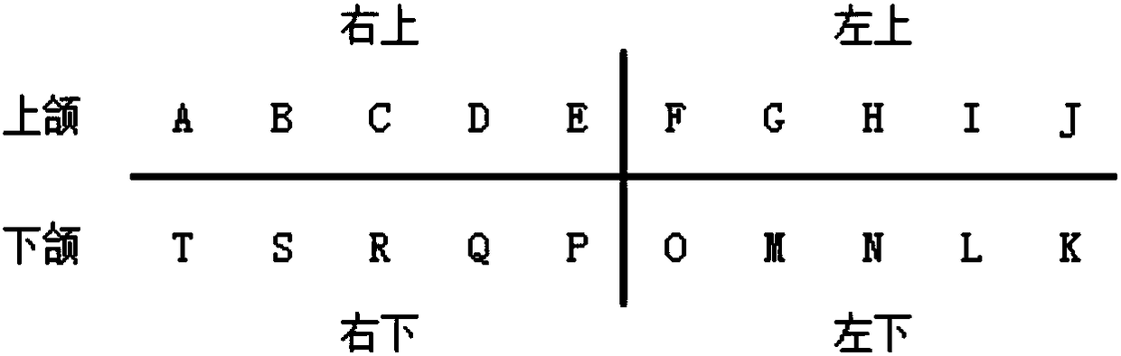 Fabricating method of all-ceramic preformed crown basic set