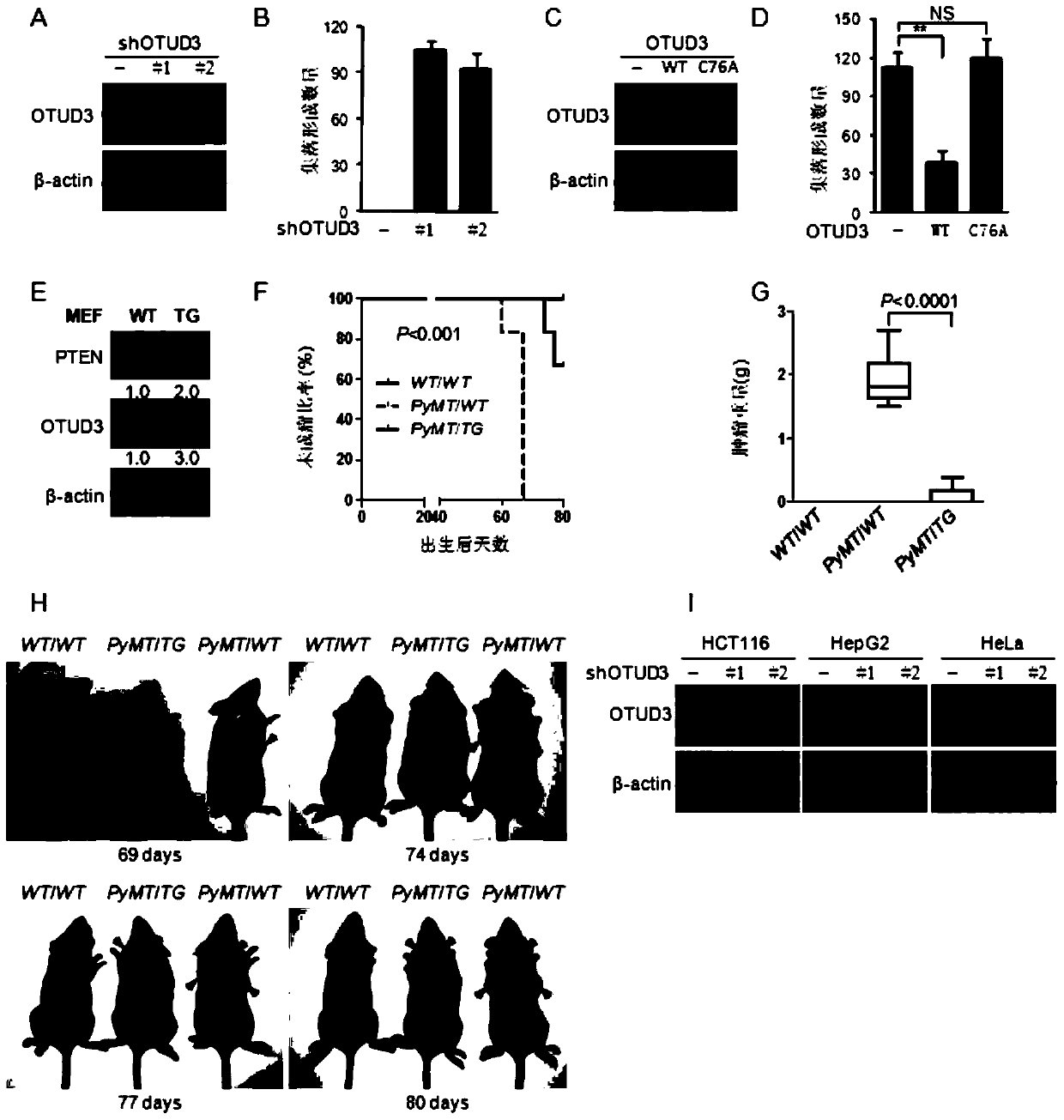 Application of OTUD3 protein in preparation of products for inhibiting tumor growth