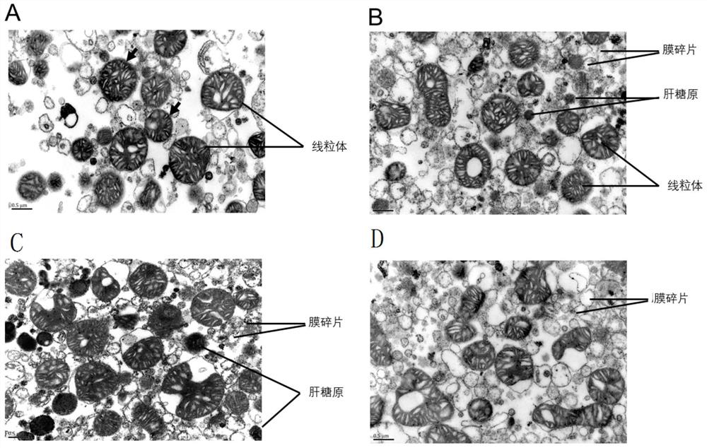 Extraction and purification method of high-activity high-purity mitochondrial