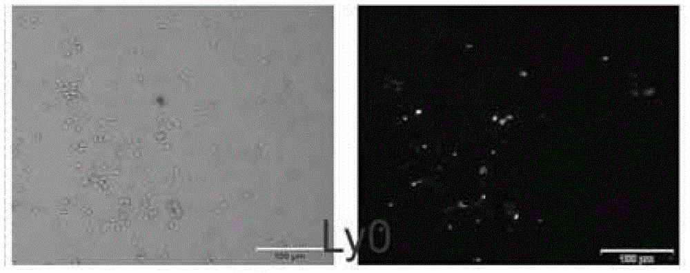 Application of lycopene in preparation of human semen cryoprotectant