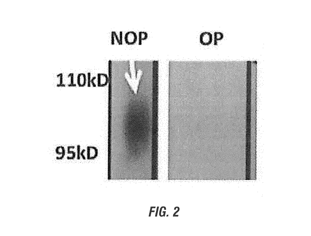 Haemophilus influenzae immunogen