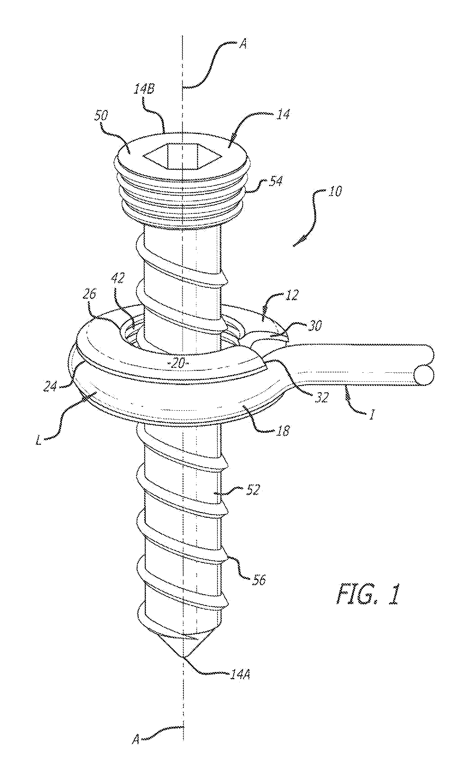 Screw fixation system