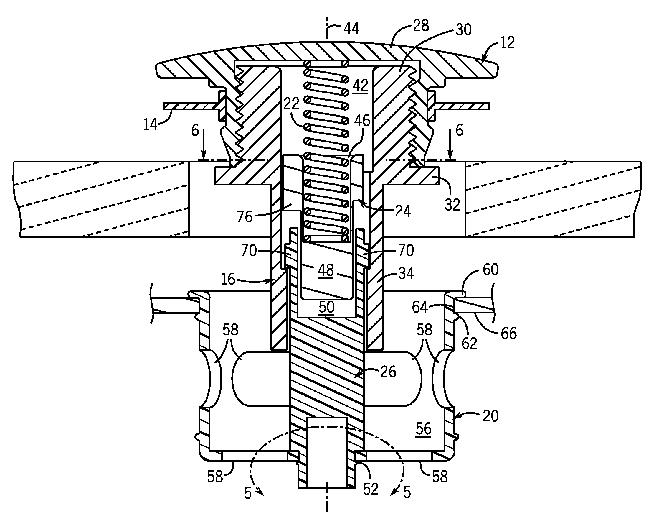 Removable pop-up drain control with catch basket