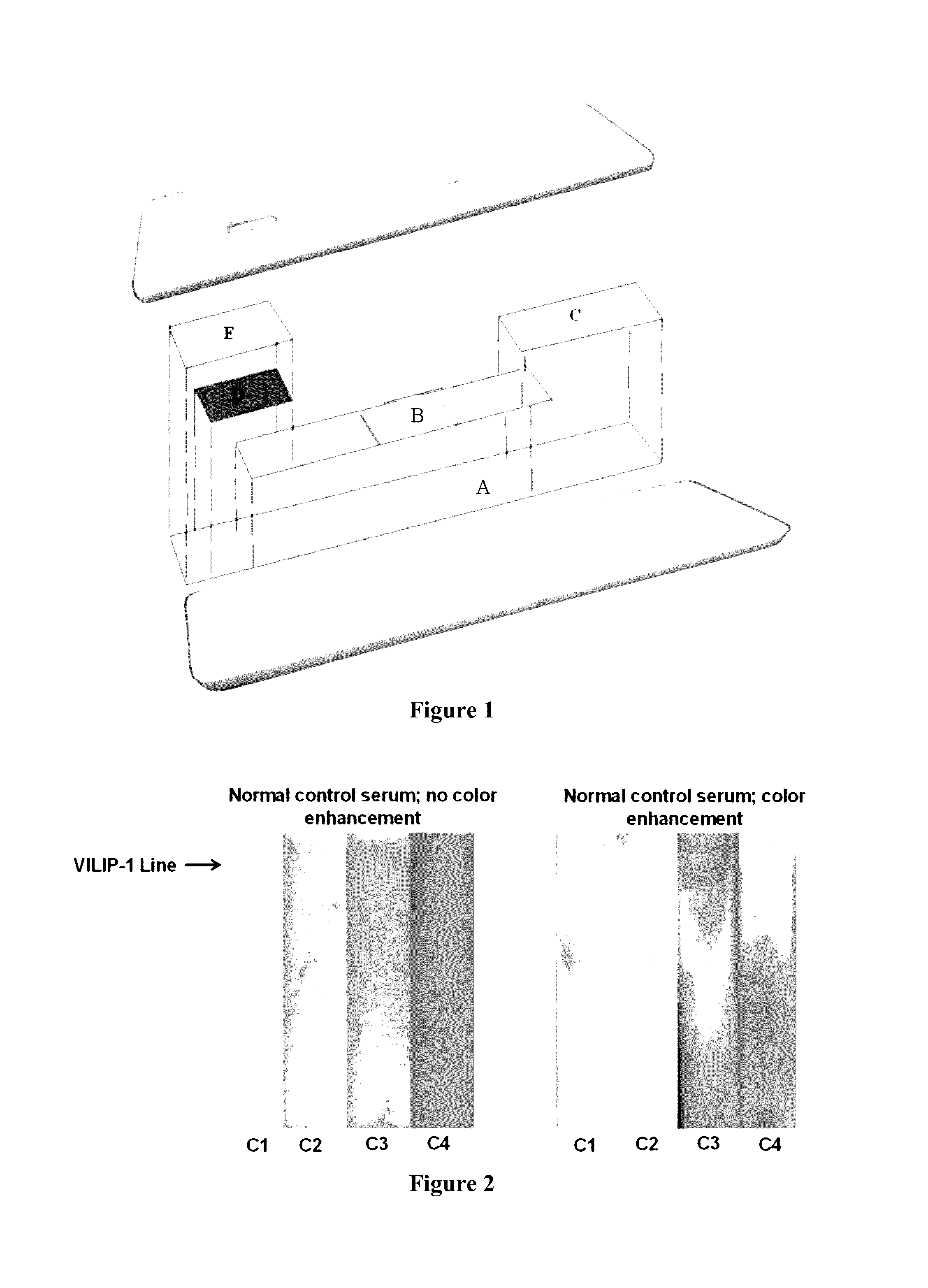 Methods and systems for prognosis and diagnosis of brain damage