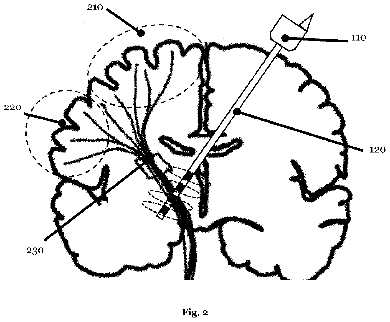 Neuronal signal system for behavior modification