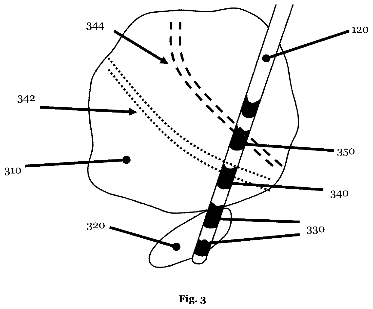 Neuronal signal system for behavior modification