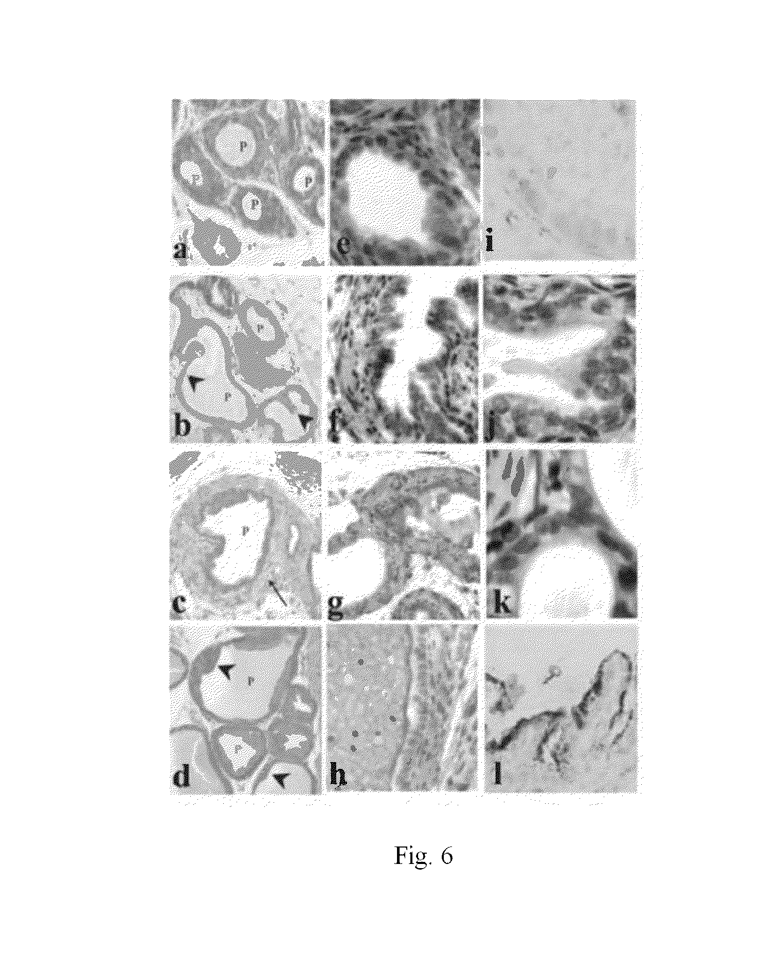 Methods for therapeutic treatment of benign prostatic hypertrophy (BPH)