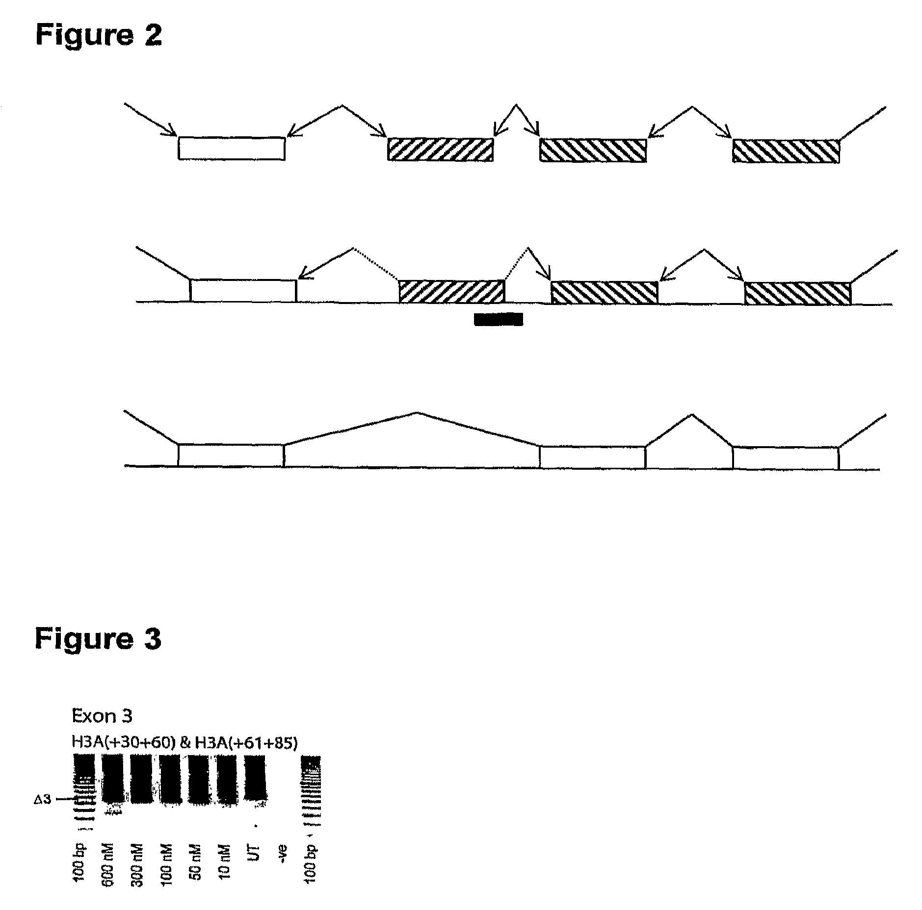 Antisense molecules and methods for treating pathologies