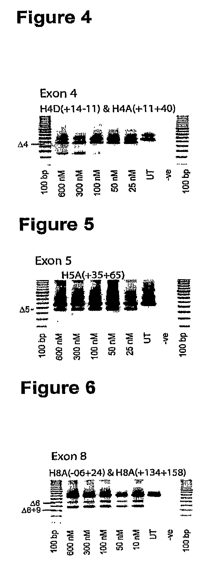 Antisense molecules and methods for treating pathologies