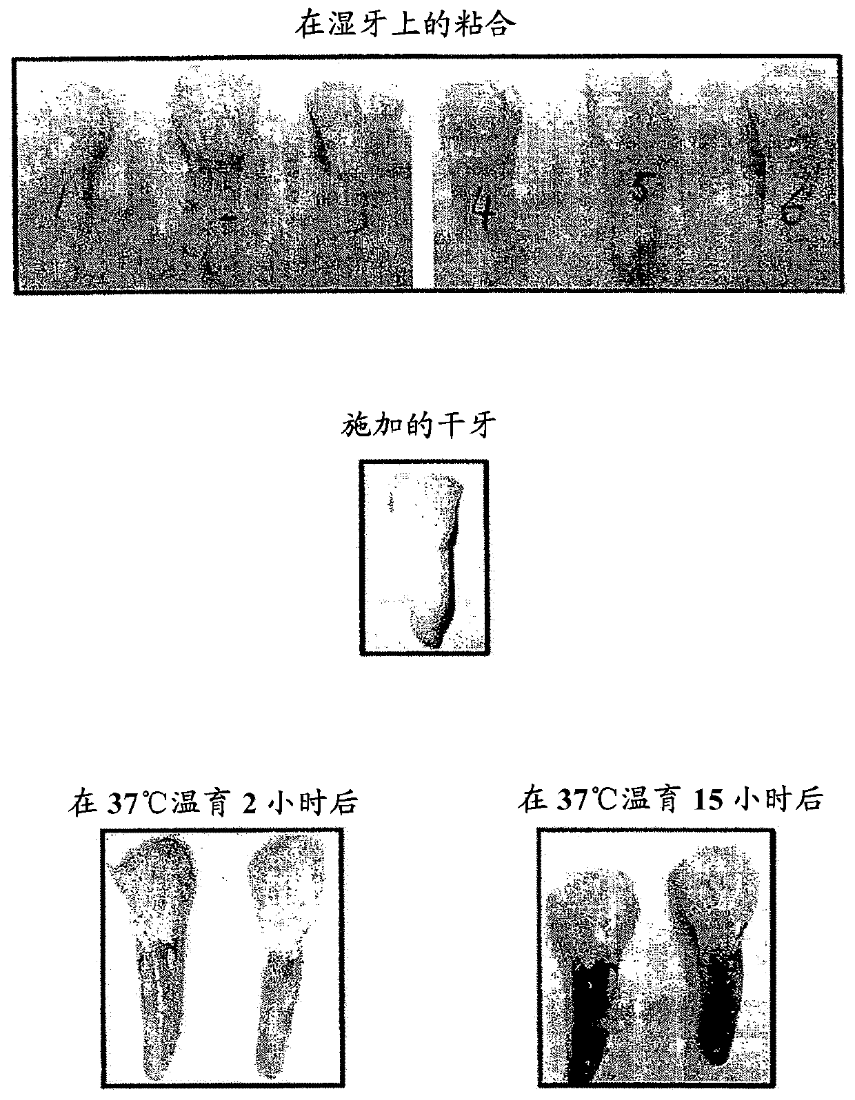 Polyphenols/peg based hydrogel system for dental varnish