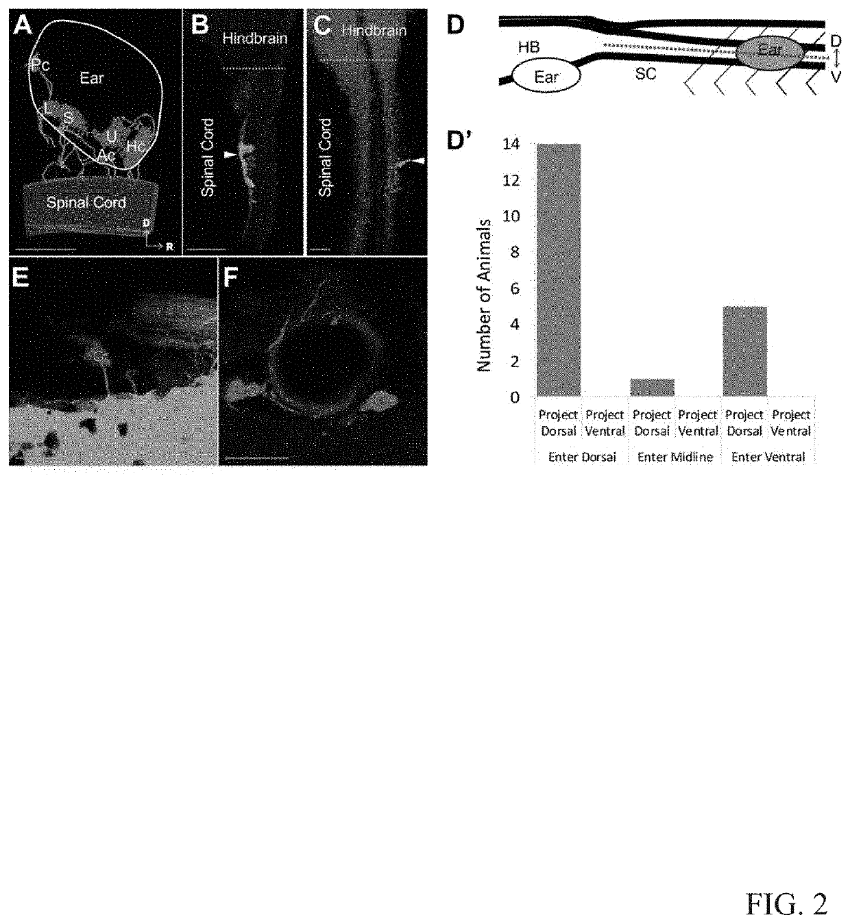 Compositions and methods torestore hearing loss and balance through embryonic ear transplant