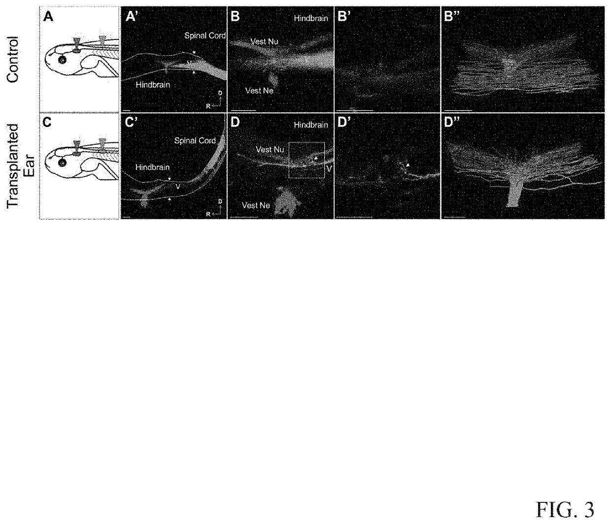 Compositions and methods torestore hearing loss and balance through embryonic ear transplant