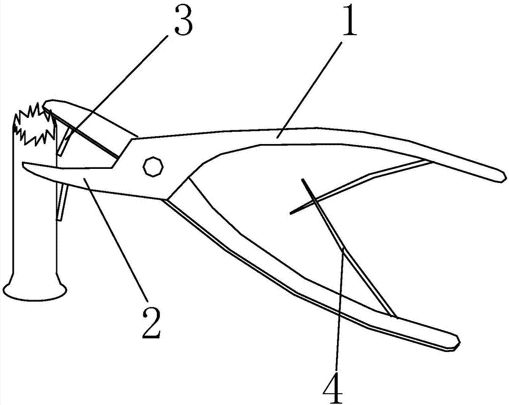 A rongeur with auxiliary fixation and calibration