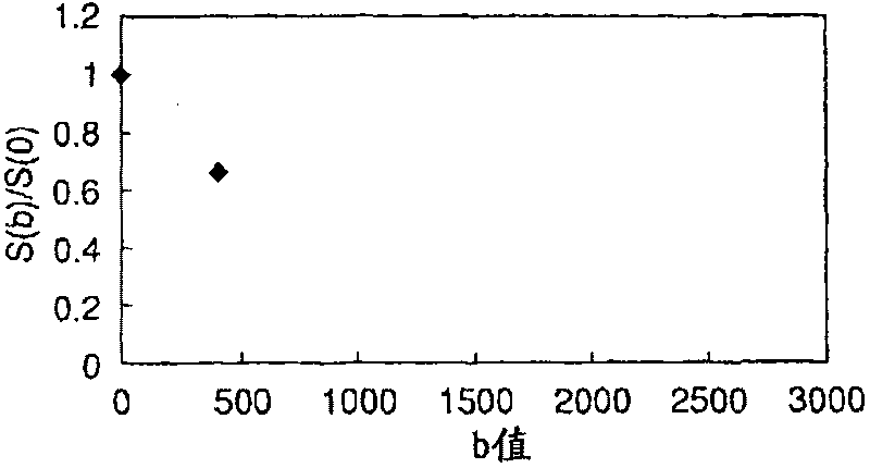 Magnetic resonance diagnostic apparatus and magnetic resonance diagnostic method