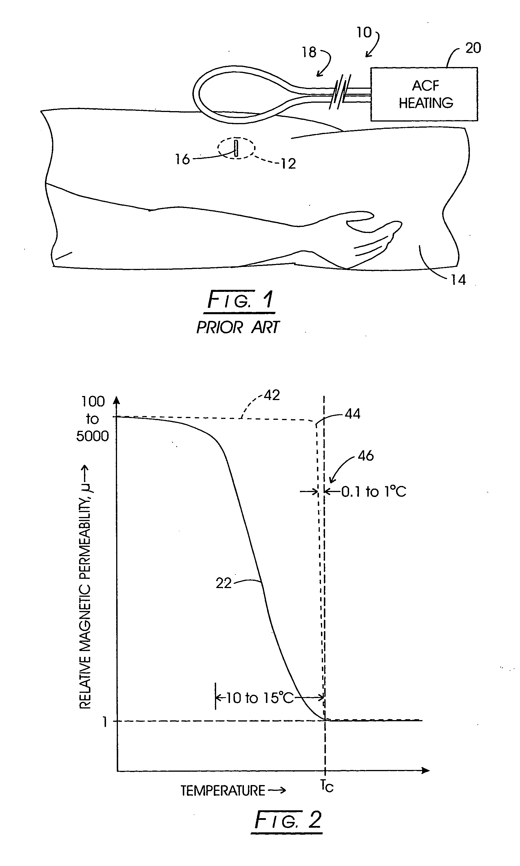 System method and apparatus for localized heating of tissue