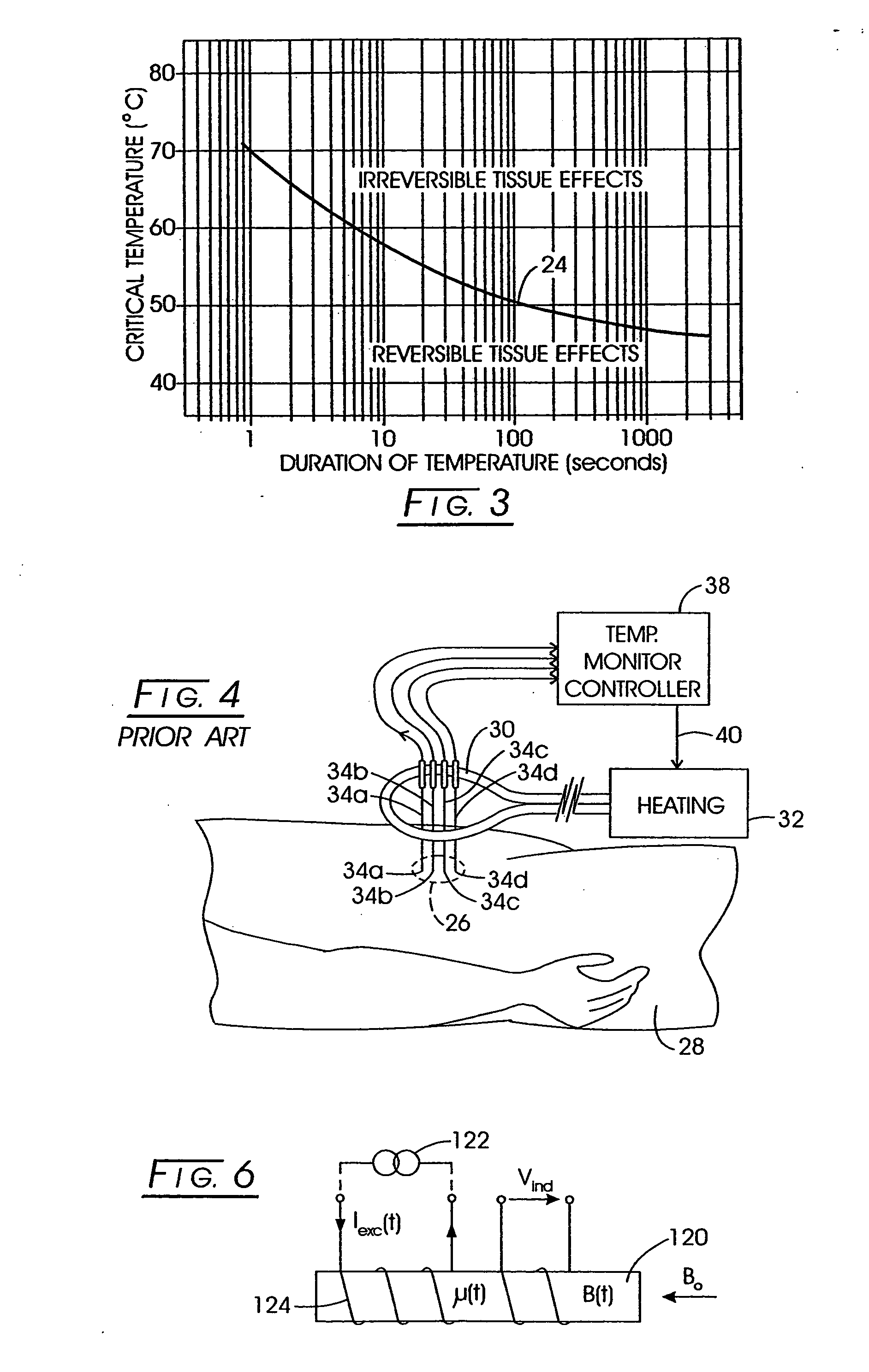 System method and apparatus for localized heating of tissue