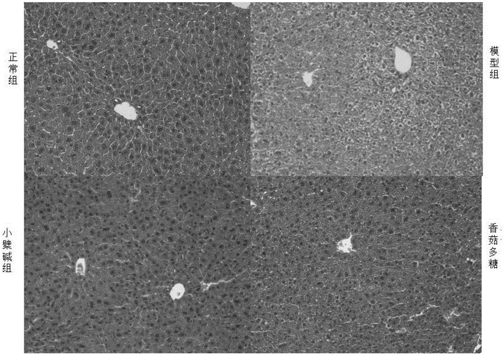 Application of lentinan in preparation of healthcare food with intestinal flora regulating function