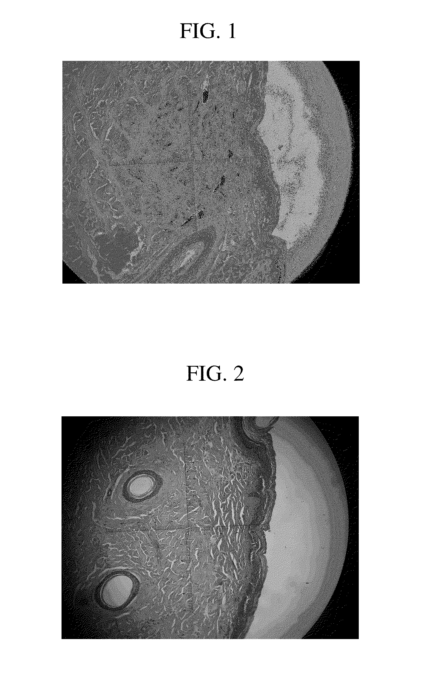 Skin resurfacing at 1930 nm