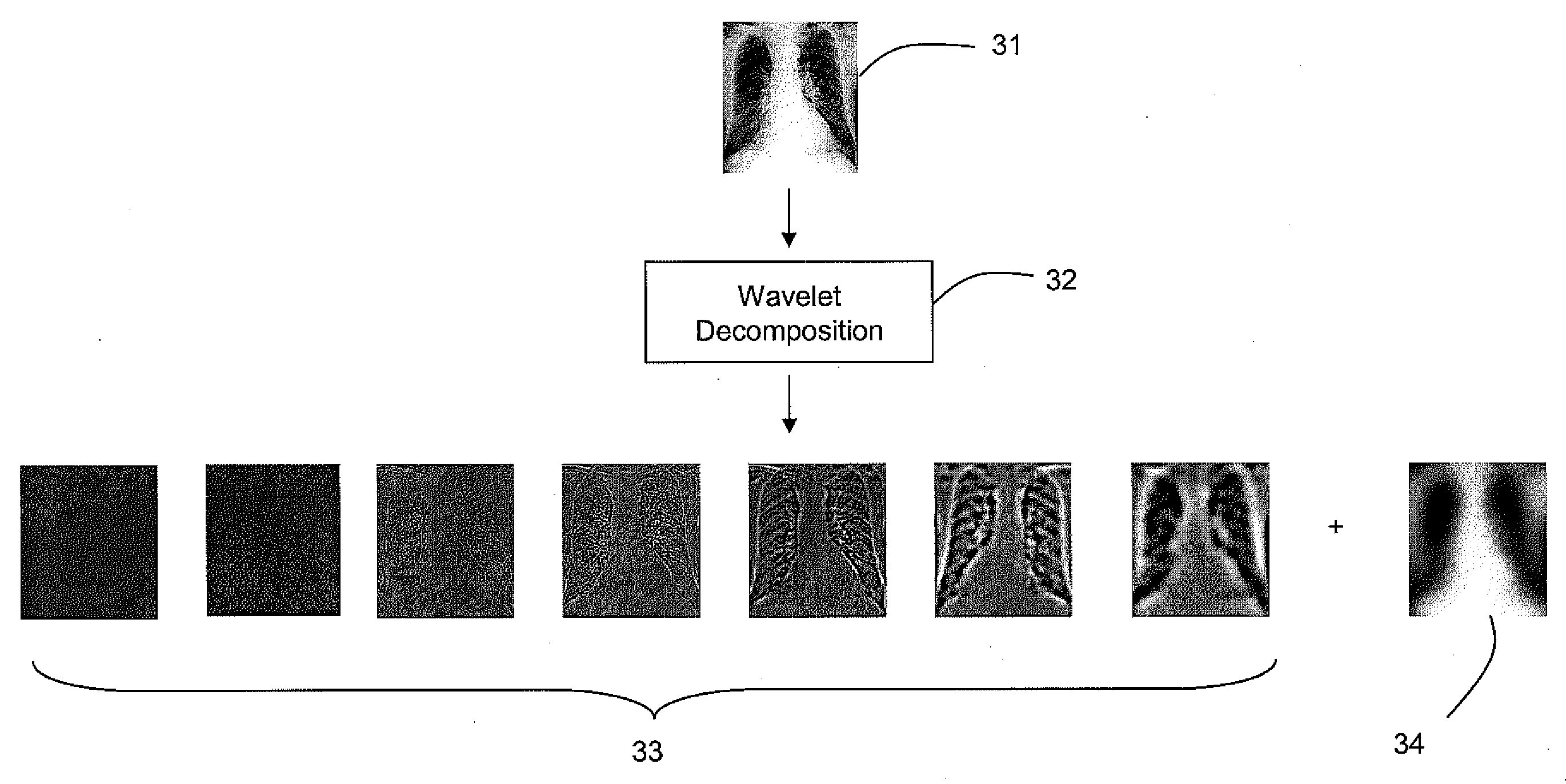 Feature based neural network regression for feature suppression